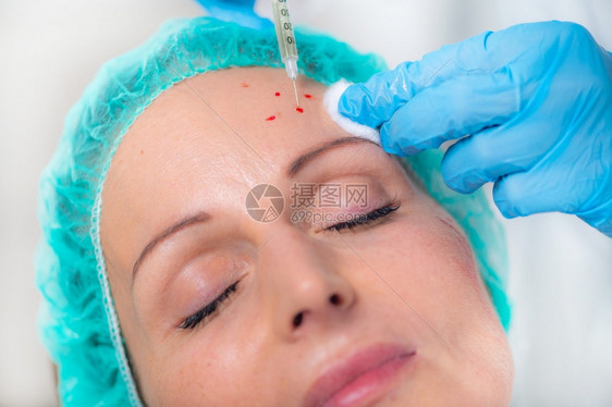 中年妇女接受血浆丰富的小板以减少皮肤皱纹口服注射治疗面部图片