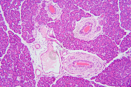 Pancres区有机背景图片