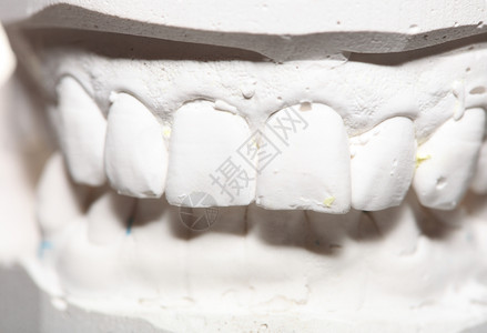 石膏模型人类下巴形态学假牙试验室技术图片