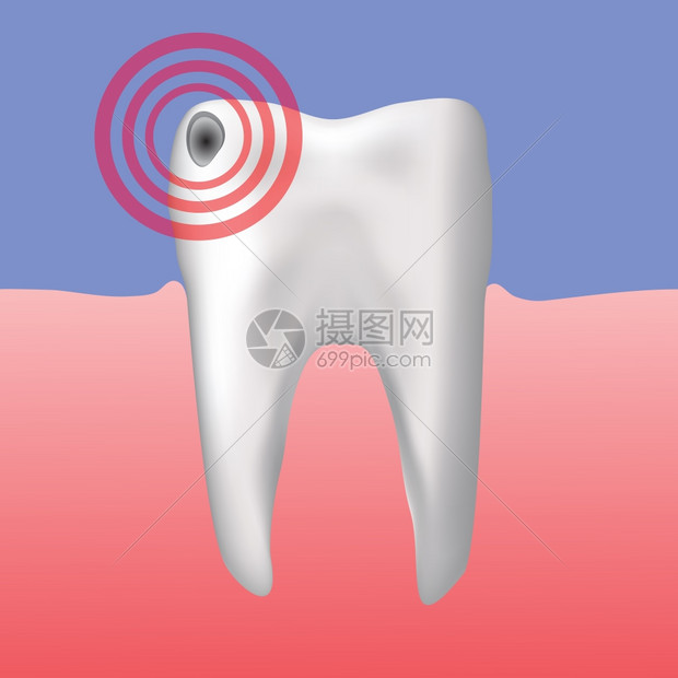 用于设计的牙齿洞色彩多插图图片