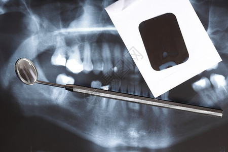 人体牙齿和镜全景X光图像扫描图片