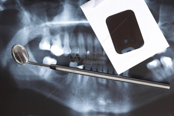 人体牙齿和镜全景X光图像扫描图片