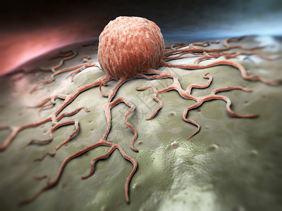癌症细胞的近视图片