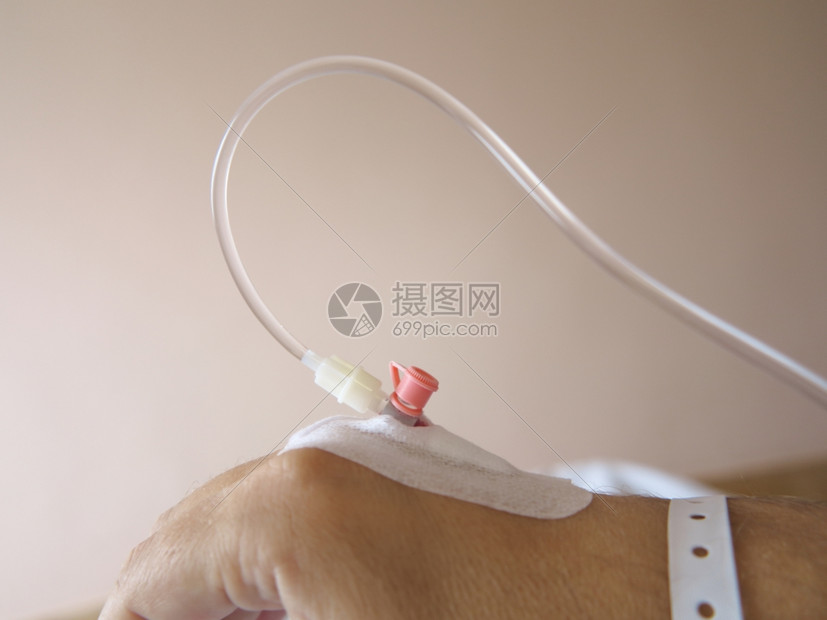 医院里一个男病人的手臂静脉注射滴液