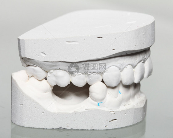 石膏模型人类下巴形态学假牙试验室技术图片