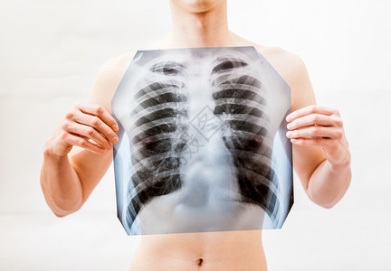 青年男子将胸口的肺部X光照射X的近距离拍摄背景图片