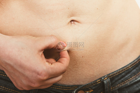人类紧的脂肪肚子超重细胞炎图片