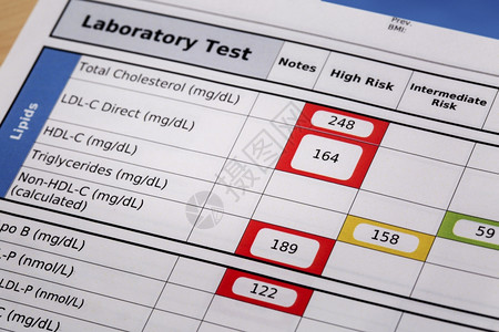 预防性侵害高风险胆固醇血液实验室检查结果的细节重点是脂质板背景