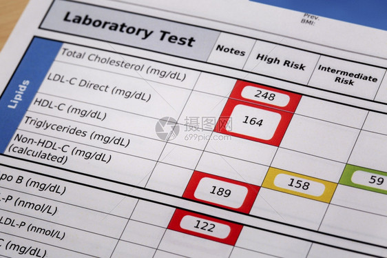高风险胆固醇血液实验室检查结果的细节重点是脂质板图片