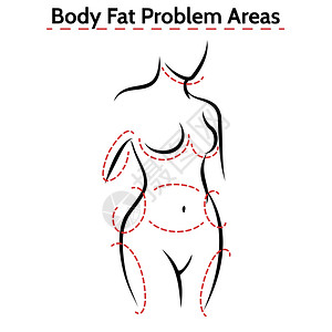 女身体脂肪问题区海报女身体脂肪问题区女身体脂肪问题区图片