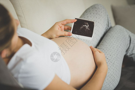 孕妇观看超声波胚胎图像的近视图片