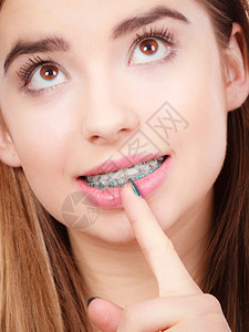 年轻女笑着用蓝色牙套显示齿女笑着用牙套显示齿图片