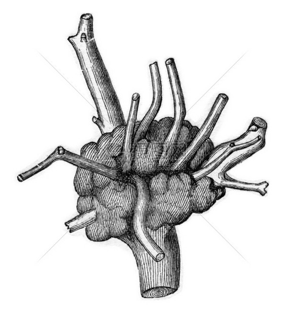 在QuercusCerris上生产的放大镜插入一个老脚Loranthus安装寄生虫图片