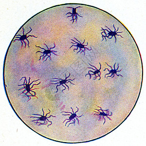 微生物自然伤寒发烧古老的刻字图解背景