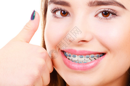 妇女微笑用蓝色的牙套拇指举起手势展示她的白牙背景图片