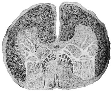 脊椎带显示后脑硬化老式刻画图解图片