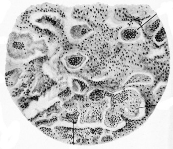 巨型细胞沙科马刻有古代画的插图图片