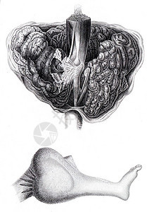 脑瘤的解剖学需要截肢的大腿古代刻图图片