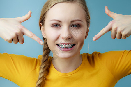 年轻女少笑着用手指牙套的穿着蓝衣服年轻女显示牙套背景图片