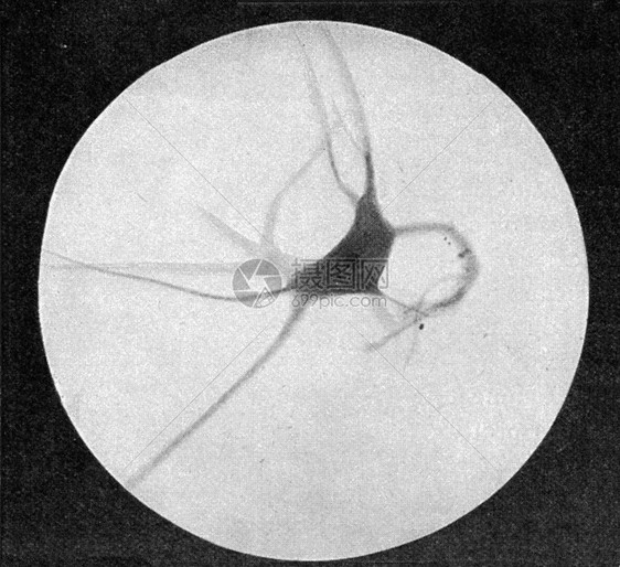 神经细胞有中等大生长古代刻画图从宇宙和人类190年图片