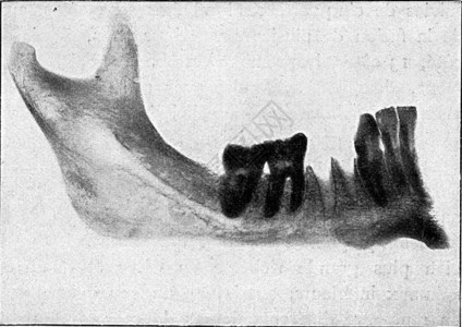 下层人体其中第三个摩尔没有达到其发育水平古老的刻画图解190年从宇宙和人类的角度图片