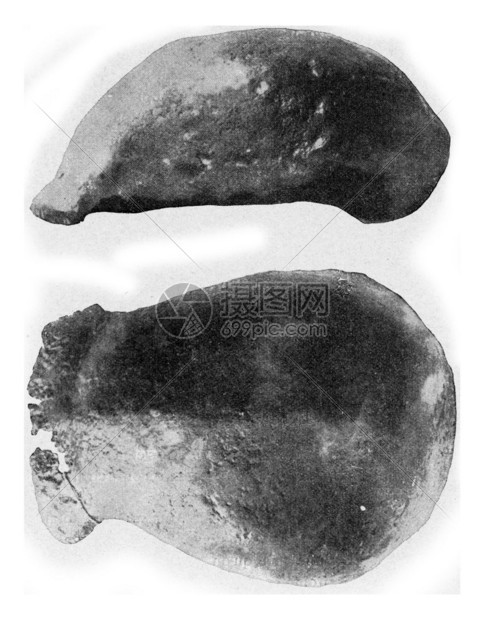 DuboisPithecuhumanus勃起的头骨上部分刻有古典画的插图190年从宇宙和人类那里得到的图片
