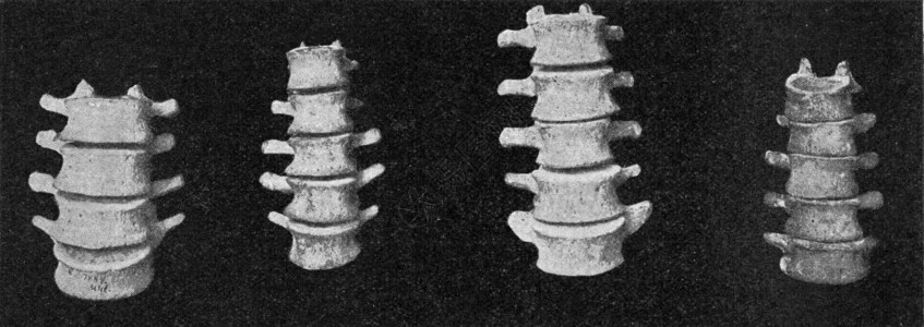 一位欧洲人澳大利亚人一位非洲和菲律宾矮人腰脊椎柱比较表由190年宇宙与人类撰写的古典插图图片