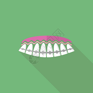 牙齿科护理背景矫形治疗卡通开口矫形治疗图片