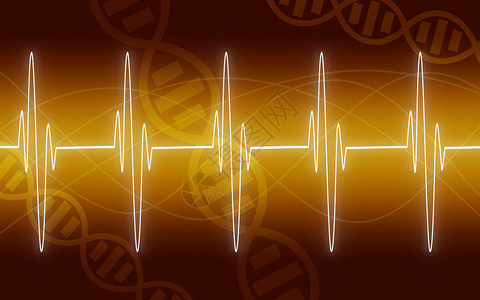 EKG黄色背景的跟踪3D转化图片