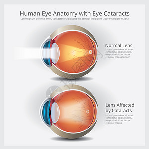 人类眼解剖矢量说明图片
