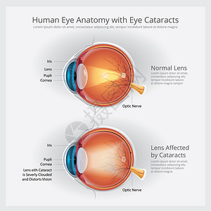 人类眼解剖矢量说明图片