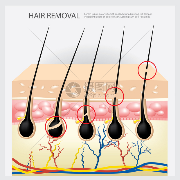 理发摘除示例矢量说明图片