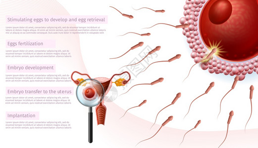 在体外受精阶段医学导师通过放大镜近距离观察女蜂窝刺激鸡蛋Emplyo开发转移至异地植入IVF病媒现实说明背景图片
