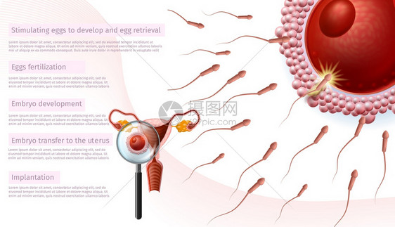 在体外受精阶段医学导师通过放大镜近距离观察女蜂窝刺激鸡蛋Emplyo开发转移至异地植入IVF病媒现实说明图片
