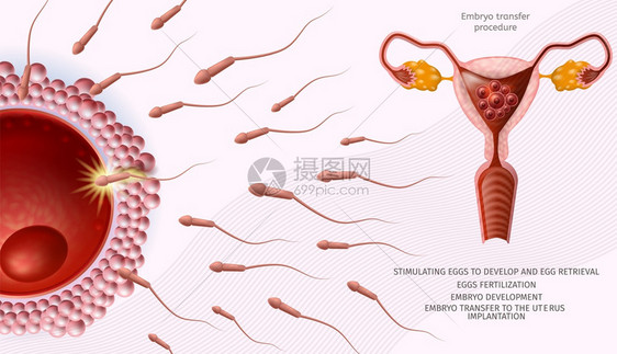 Embryo转移程序医疗银行女生育率殖人类蛋周围微小孔细胞Uterus的近距离观察矢量现实说明复制空间图片