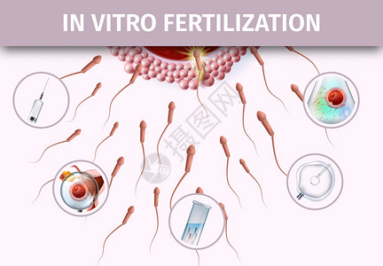 活体受精过程人工成像关于浅粉色背景的医学科详细现实说明复制IVF病媒Banner人工受精成像协助Banner图片