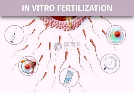 活体受精过程人工成像关于浅粉色背景的医学科详细现实说明复制IVF病媒Banner人工受精成像协助Banner图片