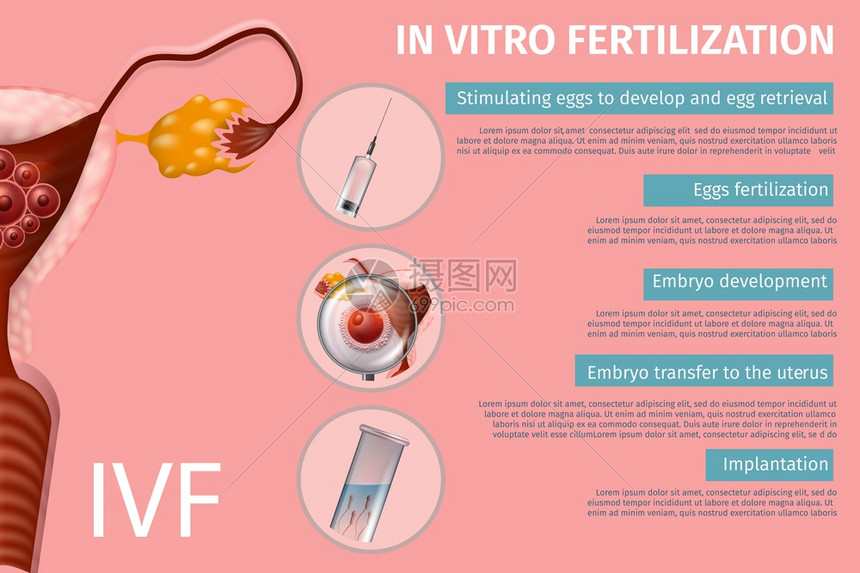体外受精阶段刺激卵embryo开发向uretrus转移植入女生殖系统ivf病媒现实说明医疗封条复制空间插画图片下载 正版图片305969291 摄图网
