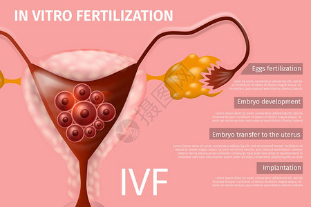 女生殖系统IVF矢量现实说明医疗容器复制空间图片