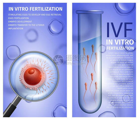 具有复制空间的体外受精垂直医疗容器带有活Spermatozons的男测试管蓝背景女卵细胞放大镜视图IVF矢量现实一说明图片