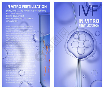 活Spermatozons的男测试管蓝渐变背景的针状女卵细胞IVF关于医疗用途的矢量现实说明图片