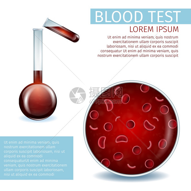 血液测试医学导管红肾细胞和血从测试管到Beaker的近视临床使用的觉材料辅助现实矢量说明复制空间临床使用的视觉材料辅助图片