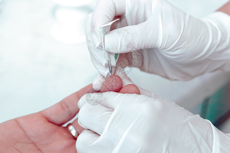 血液测试是对样本进行的实验室分析血液样本通常使用皮下针头或通过指从手臂的血管中提取图片