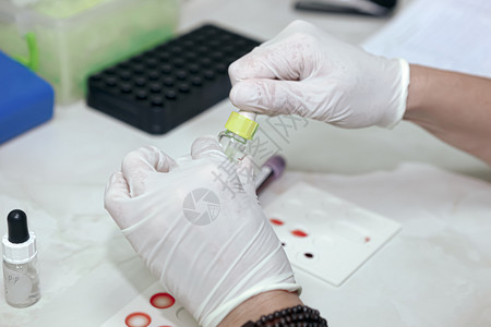 在实验室工作的科学家血液测试是对样本进行的实验室分析血液样本通常使用皮下针或手指刺从臂的血管中提取图片