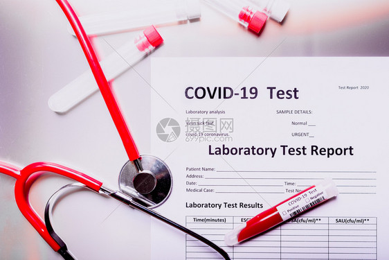 化验室报告带有冠状感染血液的测试管导致全球大风浪19图片