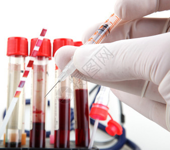 新冠新冠19研究血液测试定期验血是跟踪你整体身健康状况的最重要方法之一图片