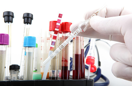 保加利亚Burgas2013年月日科学家在他的实验室工作血液测试定期验血是跟踪你总体身健康状况的最重要方法之一图片