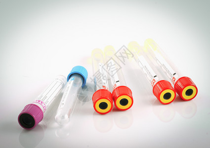 保加利亚布尔斯201年9月4日医院实验室使用的仪器实验室血液测试图片