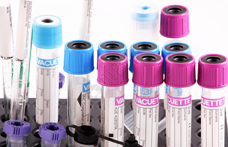 保加利亚布尔斯201年9月4日医院实验室使用的仪器实验室血液测试图片