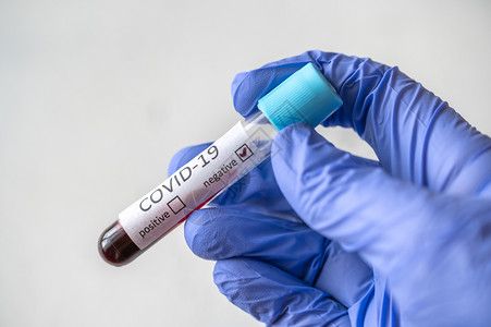 新冠19试验的血液样本测试管阴图片